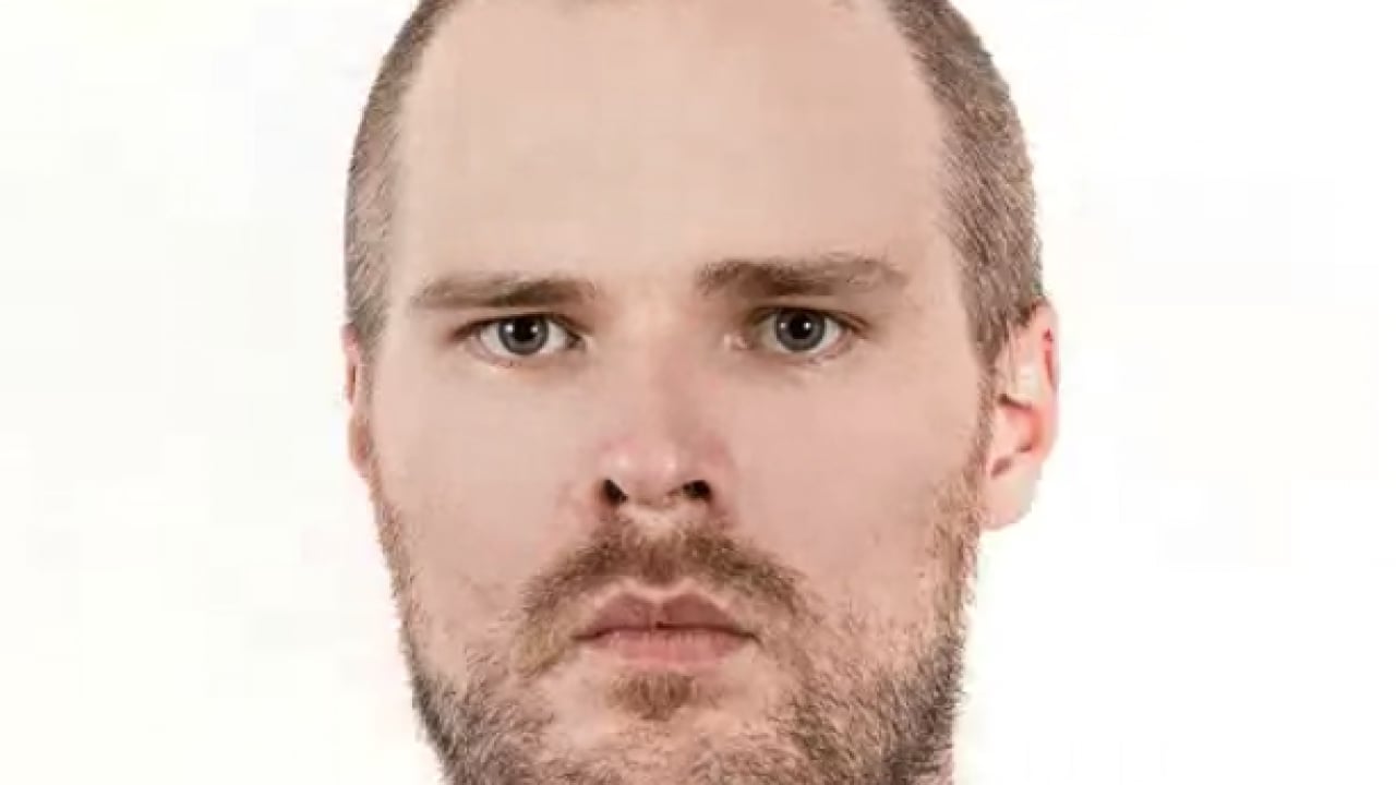 Foto - Saç dökülmesini tetikleyen en önemli alışkanlık! Uzman ismini duyurdu... Kimse farkında değil