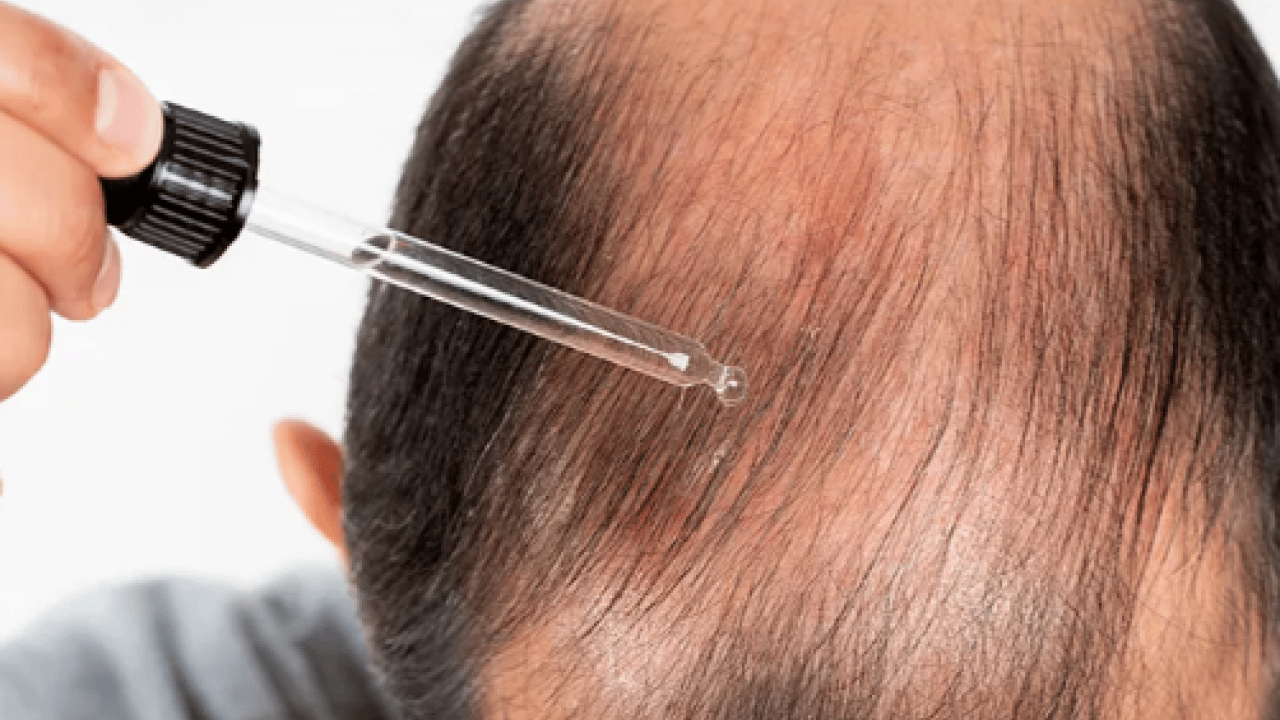 Foto - Saç dökülmesini tetikleyen en önemli alışkanlık! Uzman ismini duyurdu... Kimse farkında değil