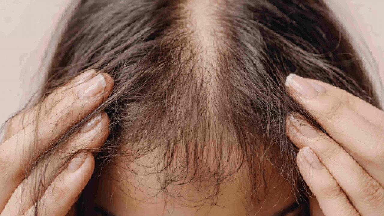 Foto - Saç dökülmesini tetikleyen en önemli alışkanlık! Uzman ismini duyurdu... Kimse farkında değil