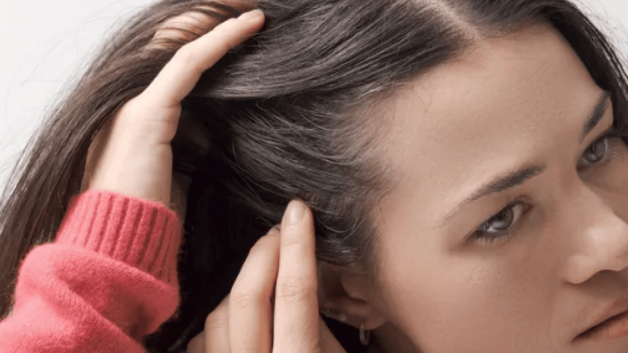 Foto - Saç seyrelmesinin sinsi habercilerine dikkat artık! Yetersiz protein ve vitamin...