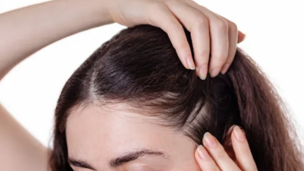 Foto - Saç seyrelmesinin sinsi habercilerine dikkat artık! Yetersiz protein ve vitamin...