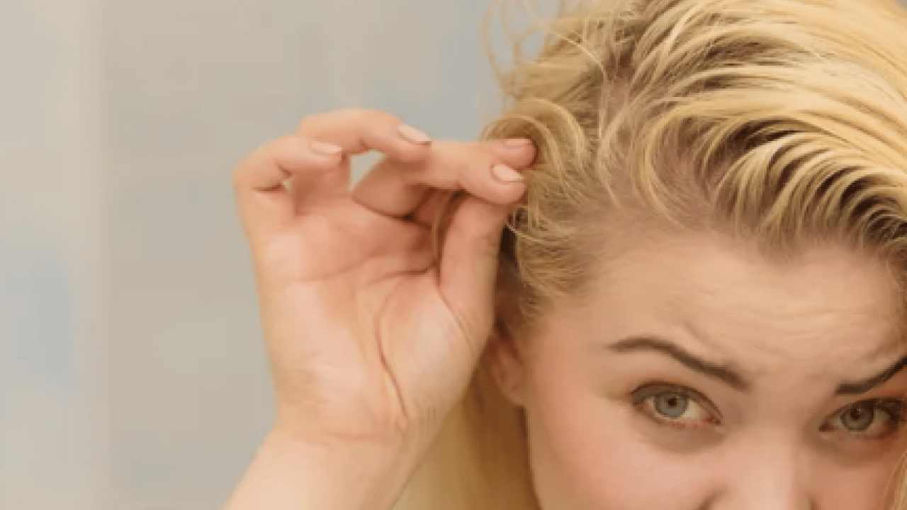 Foto - Saç seyrelmesinin sinsi habercilerine dikkat artık! Yetersiz protein ve vitamin...