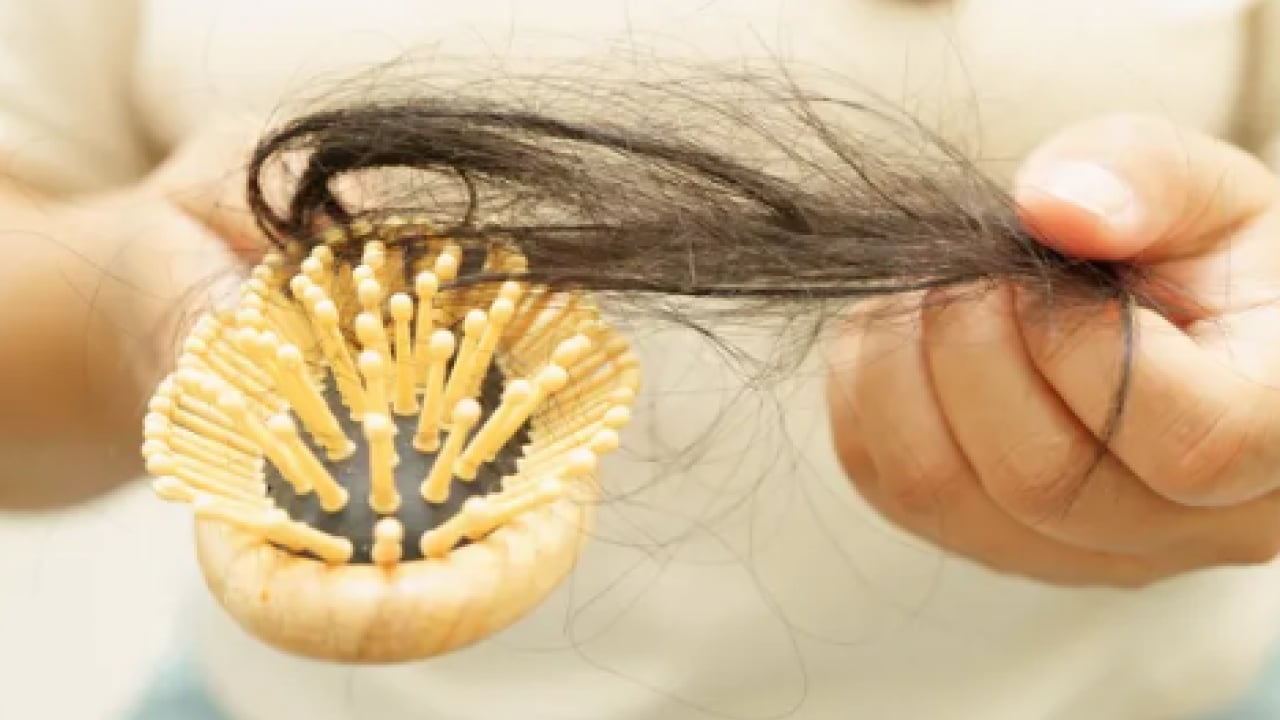 Foto - Saç seyrelmesinin sinsi habercilerine dikkat artık! Yetersiz protein ve vitamin...