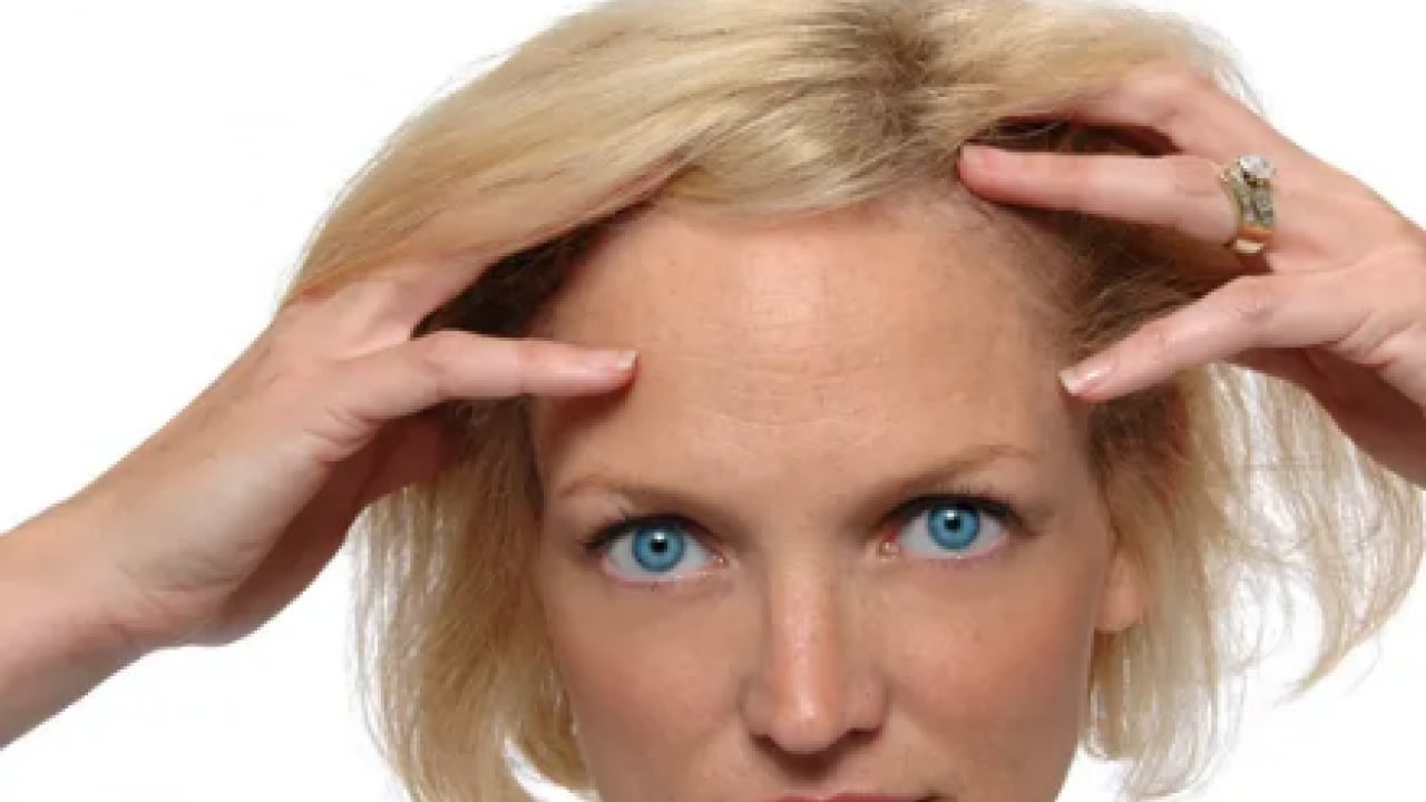 Foto - Saç seyrelmesinin sinsi habercilerine dikkat artık! Yetersiz protein ve vitamin...