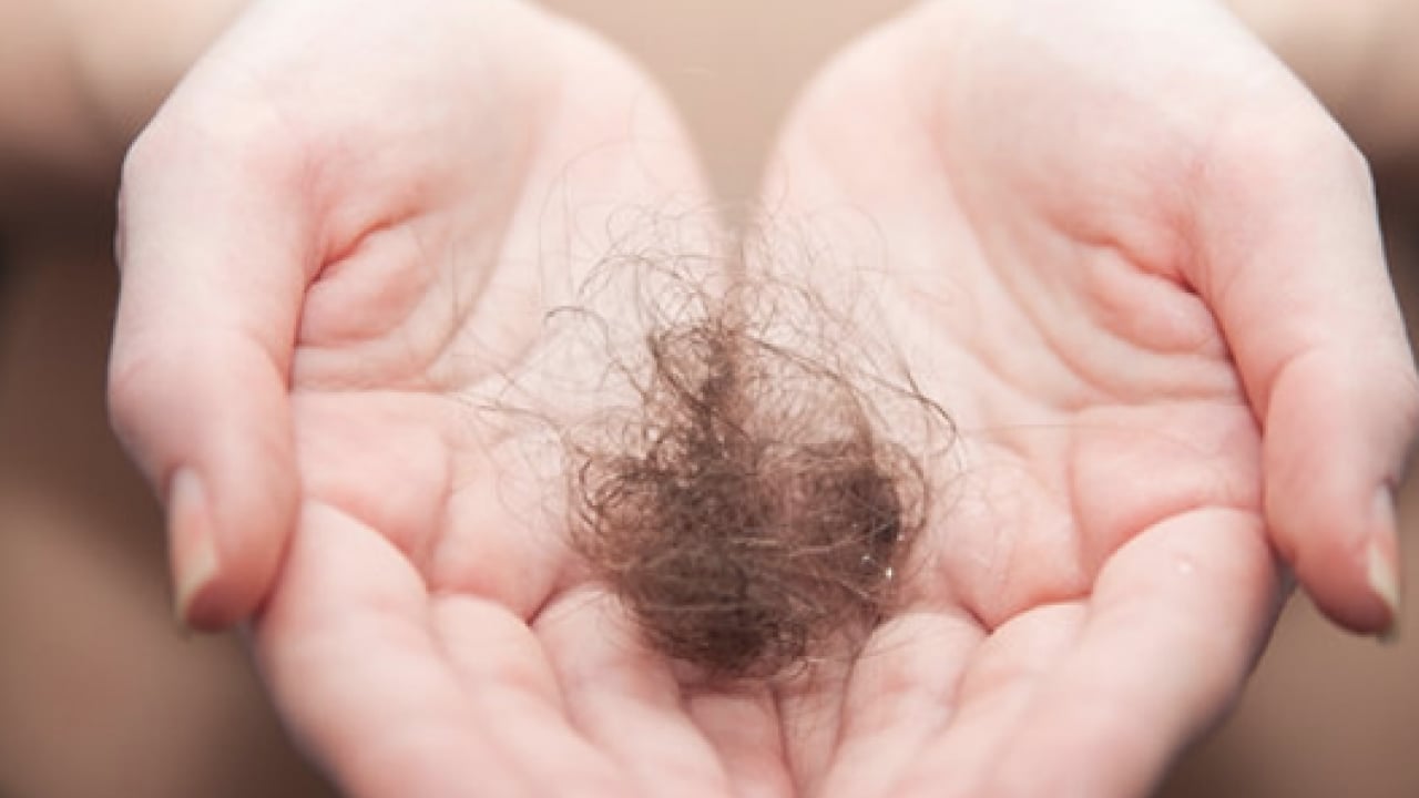 Foto - Saç trendi yayılıyor: Saçı yıkamama! Doğal saç derisindeki bakteri ve mantar dengesinin bozuluyor