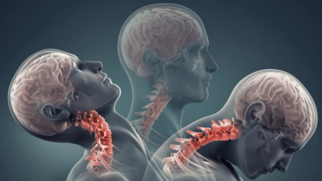 Sadece diske müdahale yeterli değil: Bel ve boyun fıtığı hastalarına önemli tavsiyeler...