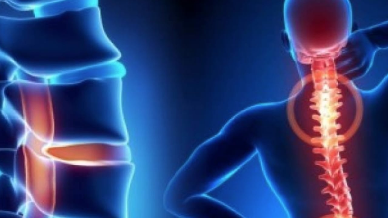 Foto - Sadece diske müdahale yeterli değil: Bel ve boyun fıtığı hastalarına önemli tavsiyeler...