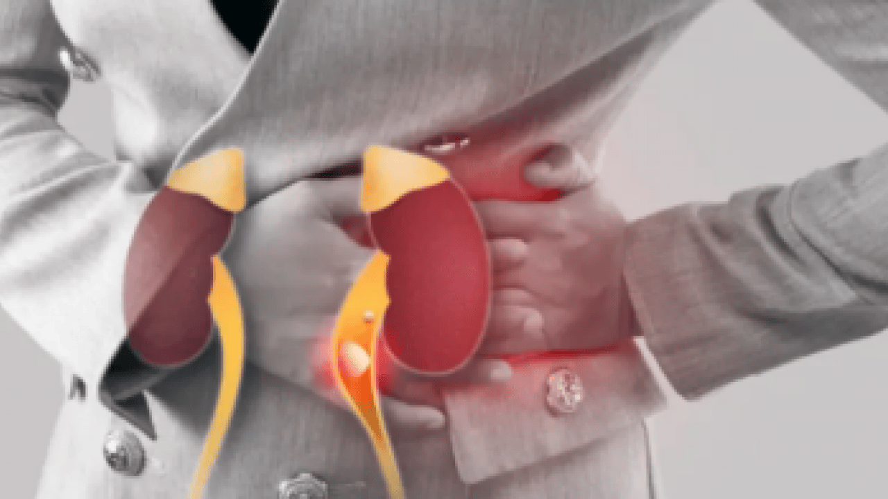 Foto - Sağlık Bakanlığı'ndan kritik uyarı: Erken tanı hayat kurtarır! Her 7 kişiden biri böbrek hastası