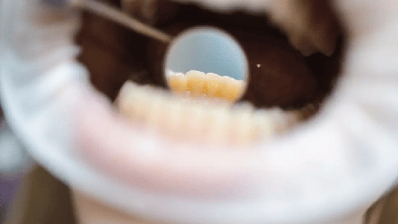 Foto - Sağlıklı diye tüketiliyor: Meğer dişleri eritiyormuş!