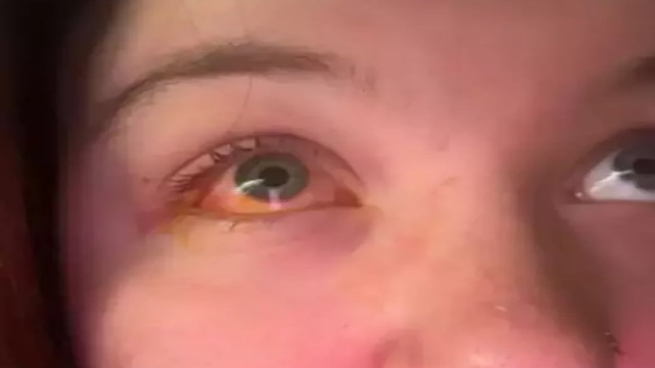 Foto - Sakın ha sakın bu hatayı yapmayın! Yatmadan önce çamaşır yıkadı, sabah kör uyandı