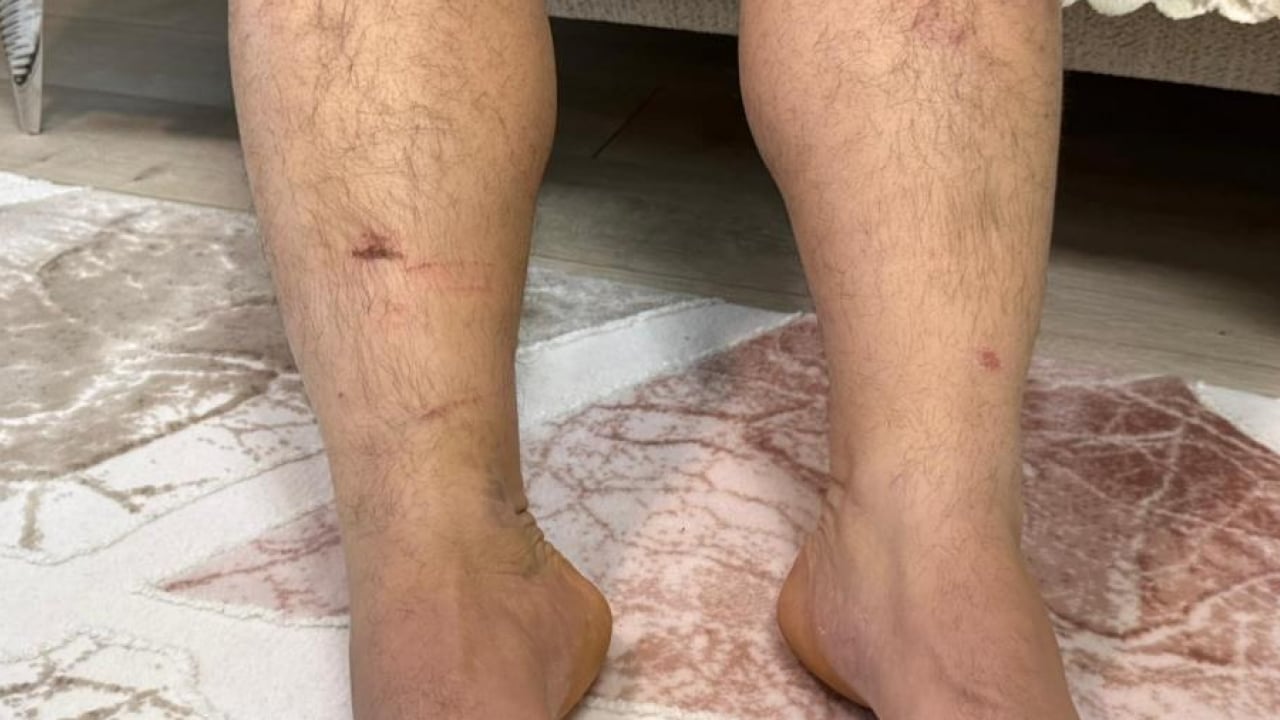 Foto - Şantiyede aile içi şiddet kâbusu! Kuzenleri tarafından kaçırıldı: Kelepçe takıp ölümle tehdit ettiler