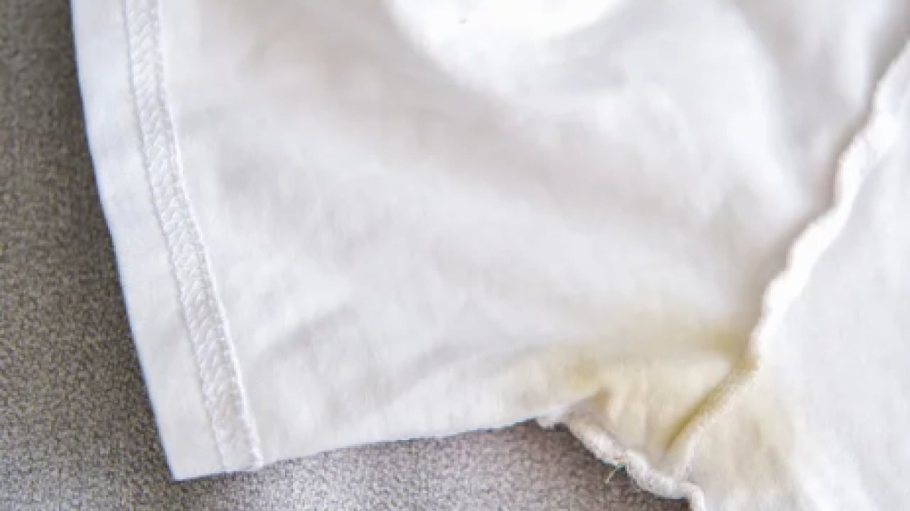 Foto - Sararan atletler artık kar gibi bembeyaz olacak! Tek adımla müthiş çözüme mutlaka bakın...