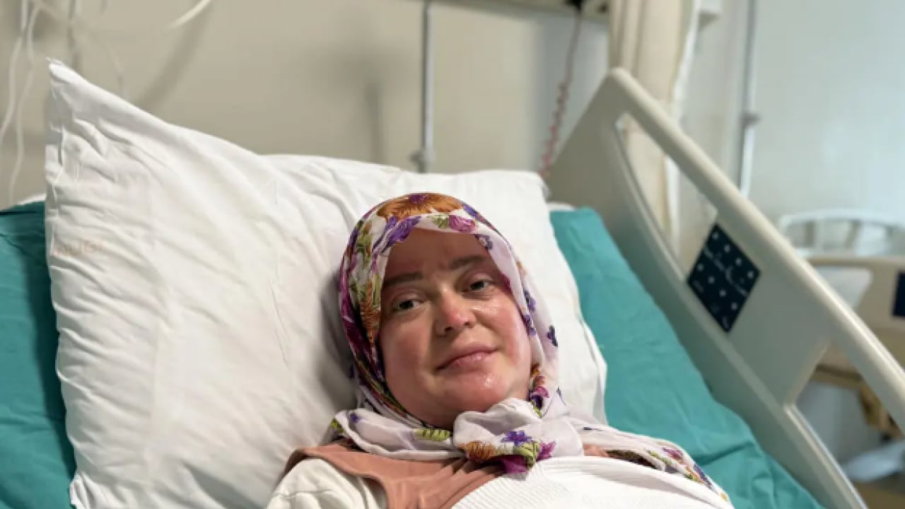 Foto - Satın almadan önce iki kez düşünün: Vücudunun yüzde 70'i yandı!