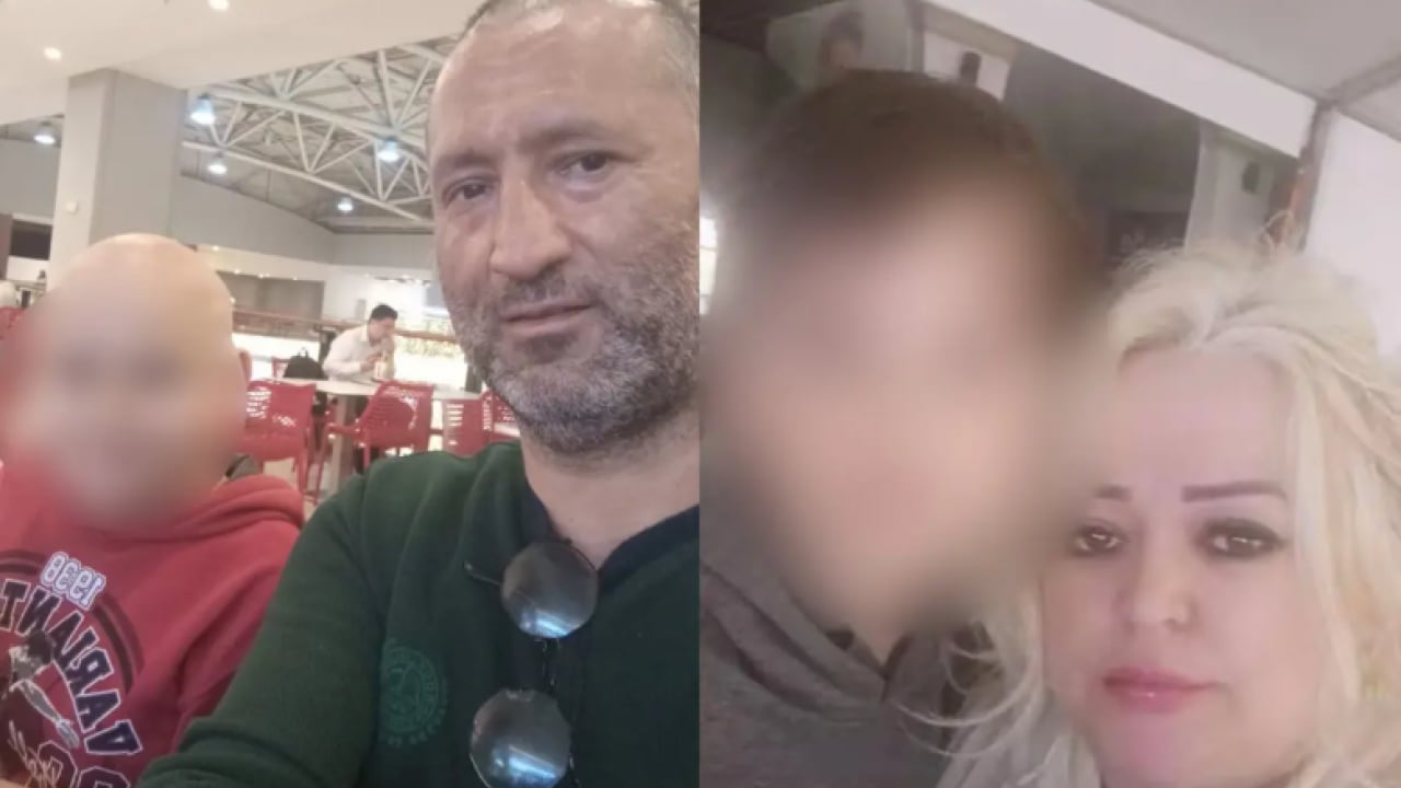 Foto - Satın almadan önce iki kez düşünün: Vücudunun yüzde 70'i yandı!