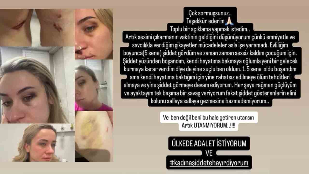 Foto - Sebebi futbol değil, duyunca şaşıracaksınız! Yeşil sahada tekme tokat dayak