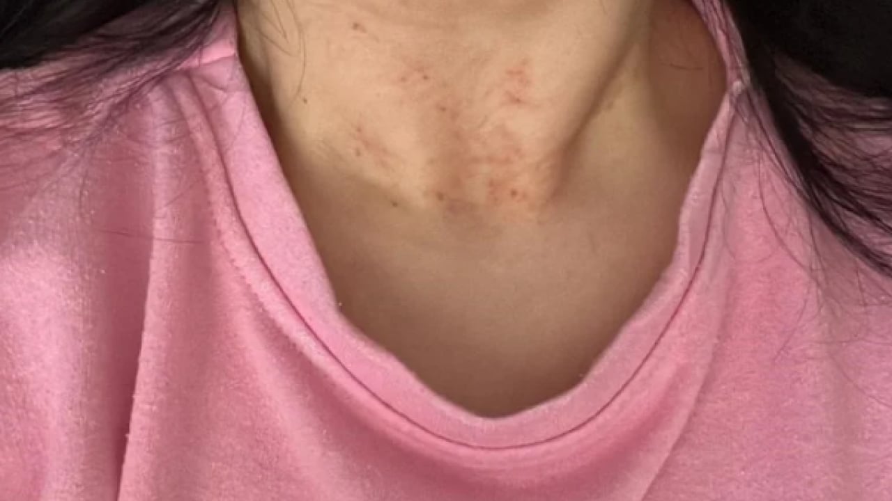 Foto - Seküler sapkın zihniyet sokaklara taştı! Evlilik dışı ilişkiyi reddeden kadına dehşeti yaşattı