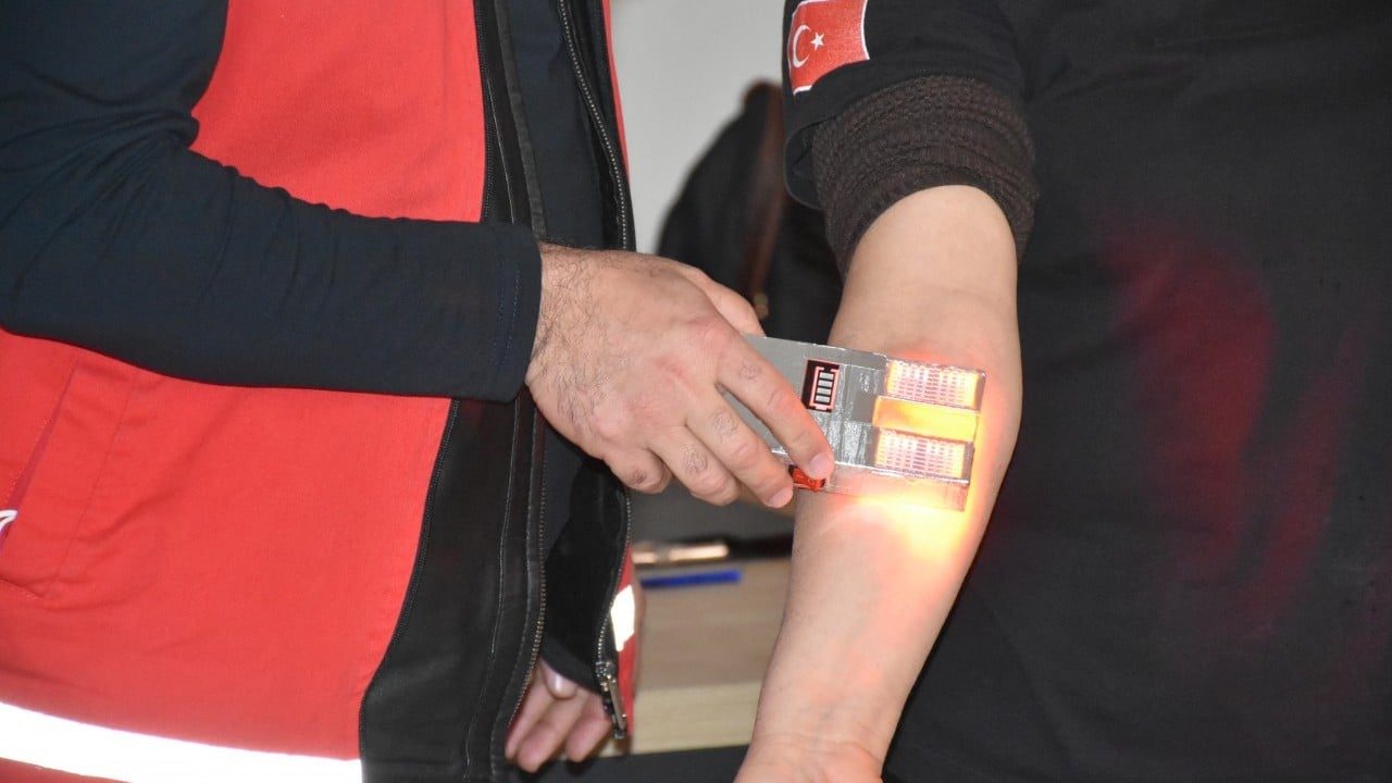 Foto - Ses getirecek buluş! Devreye aldılar artık: İşte huzurlarınızda 'damar bulucu'