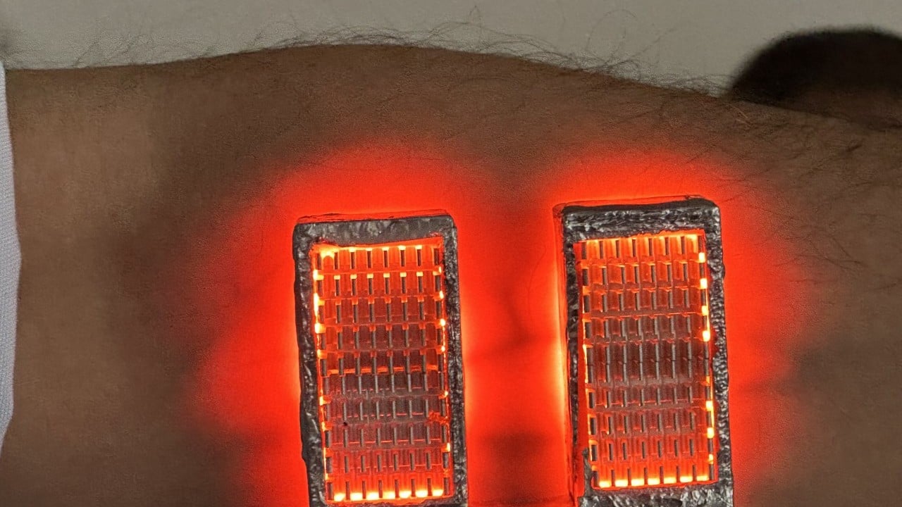 Foto - Ses getirecek buluş! Devreye aldılar artık: İşte huzurlarınızda 'damar bulucu'