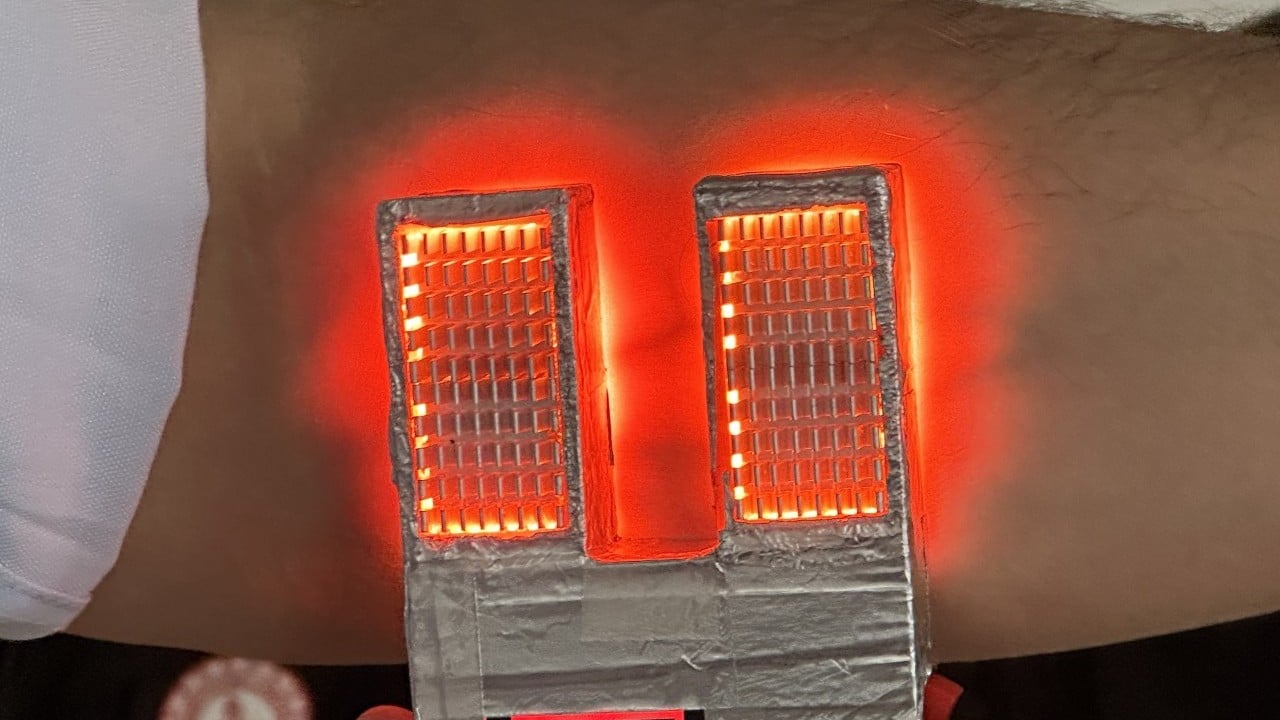 Foto - Ses getirecek buluş! Devreye aldılar artık: İşte huzurlarınızda 'damar bulucu'