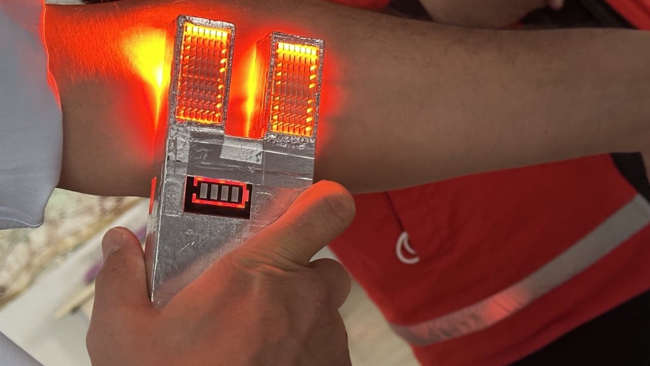 Foto - Ses getirecek buluş! Devreye aldılar artık: İşte huzurlarınızda 'damar bulucu'