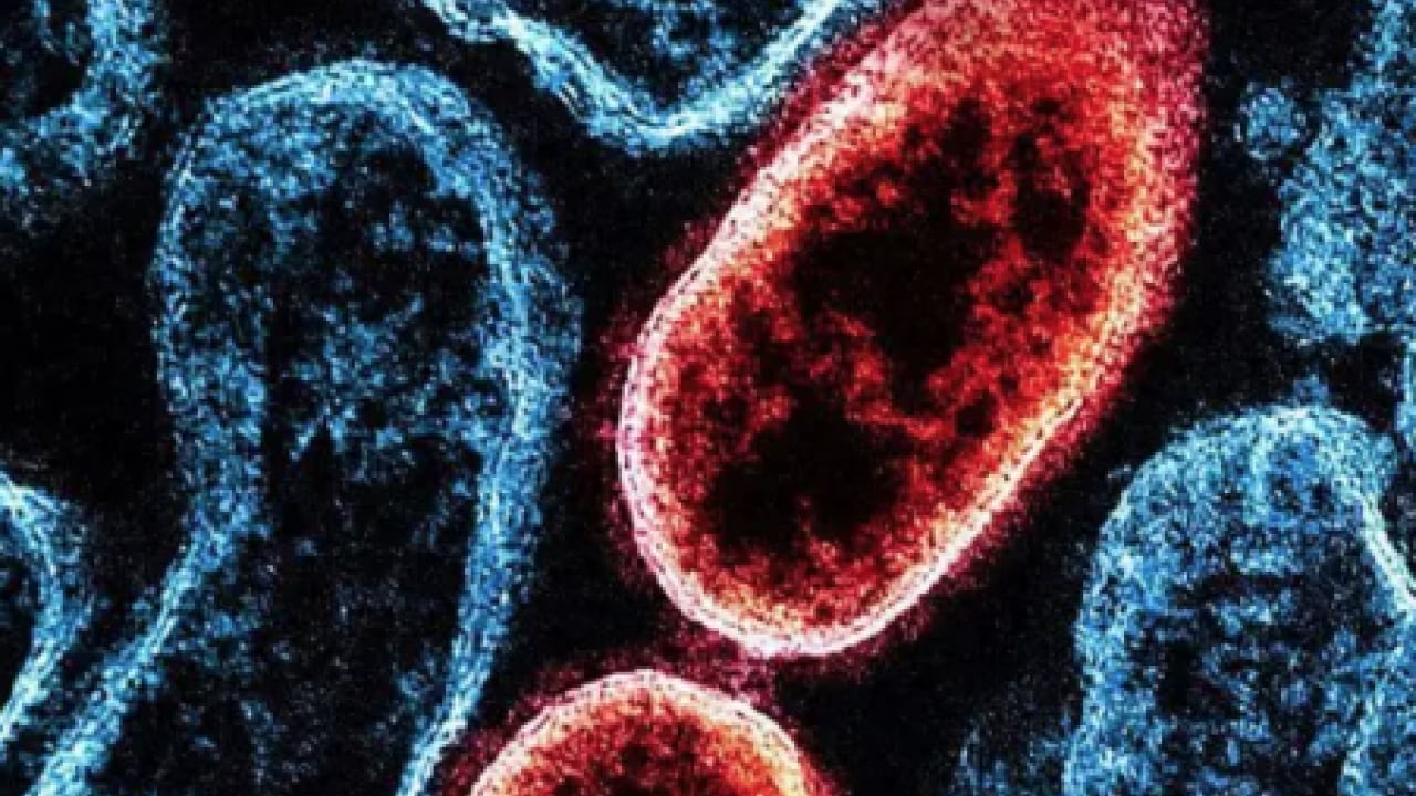 Foto - Sessiz alarm yeniden hortladı: Hindistan'da yayılan ölümcül virüs kapıda mı?