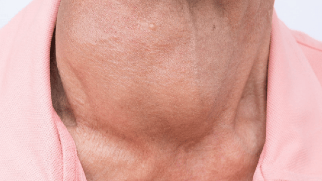 Foto - Sessiz ilerliyor! Bunu yapmak basit: Tiroit sağlığı için herkes kilosuna dikkat etsin!