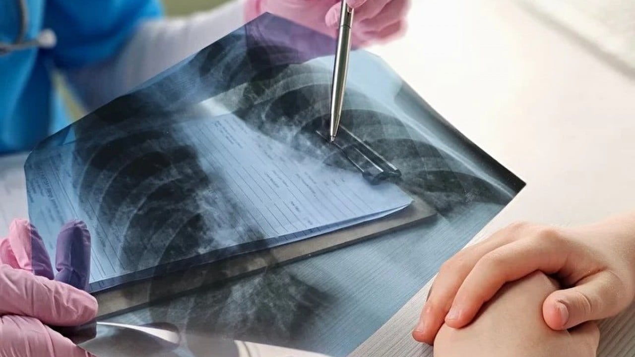 Foto - Sessiz tehlike göz göre göre yaklaşıyor! Uzmanlar o hastalık için uyardı