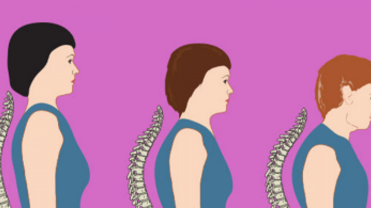 Foto - Sessiz tehlike: Osteoporoz! Kemik erimesi olayının ehemmiyetini algılamalısınız...