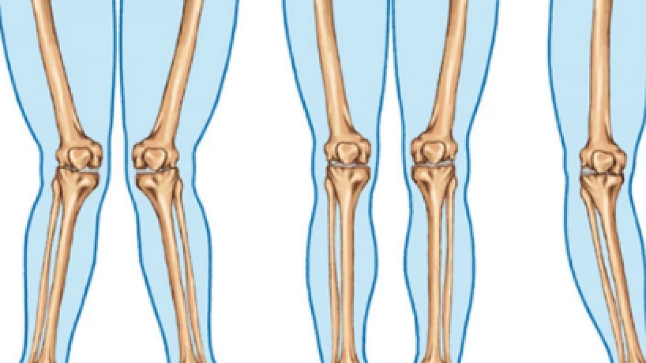 Foto - Sessiz tehlike: Osteoporoz! Kemik erimesi olayının ehemmiyetini algılamalısınız...