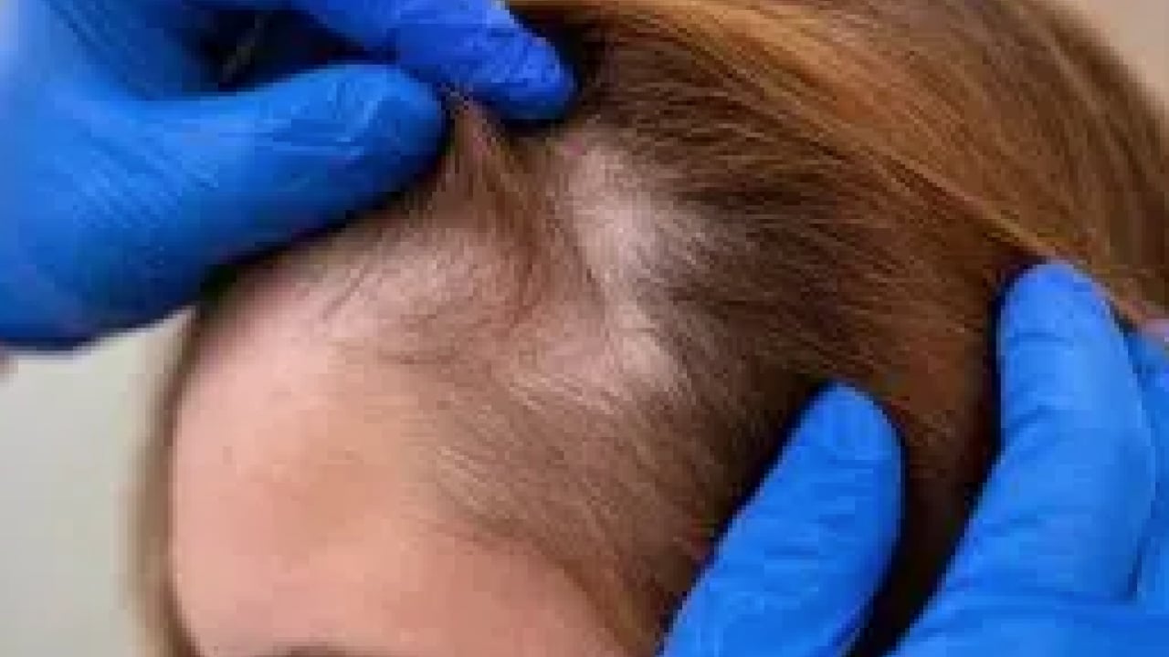 Foto - Seyrek saçların sebebi banyodaki o hatada gizli! İşte saçları gürleştiren formül