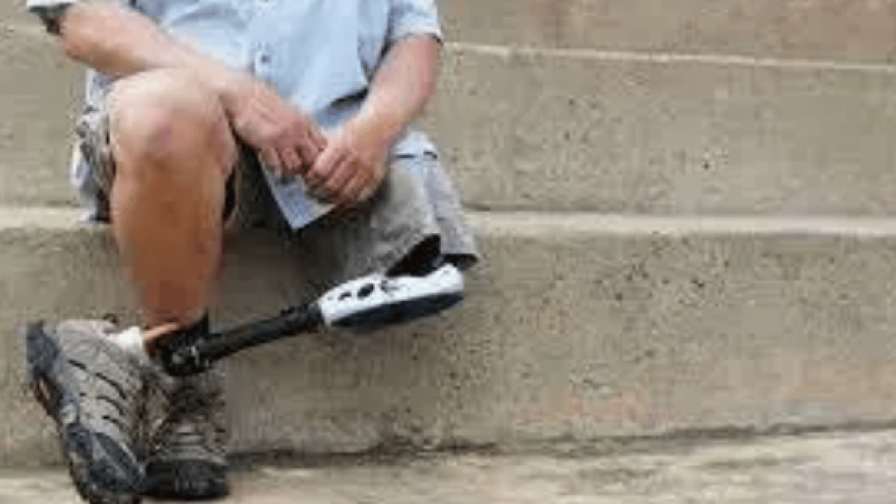 Foto - SGK listeyi paylaştı: Bu hastalığı olanlar malulen emekli olacak!