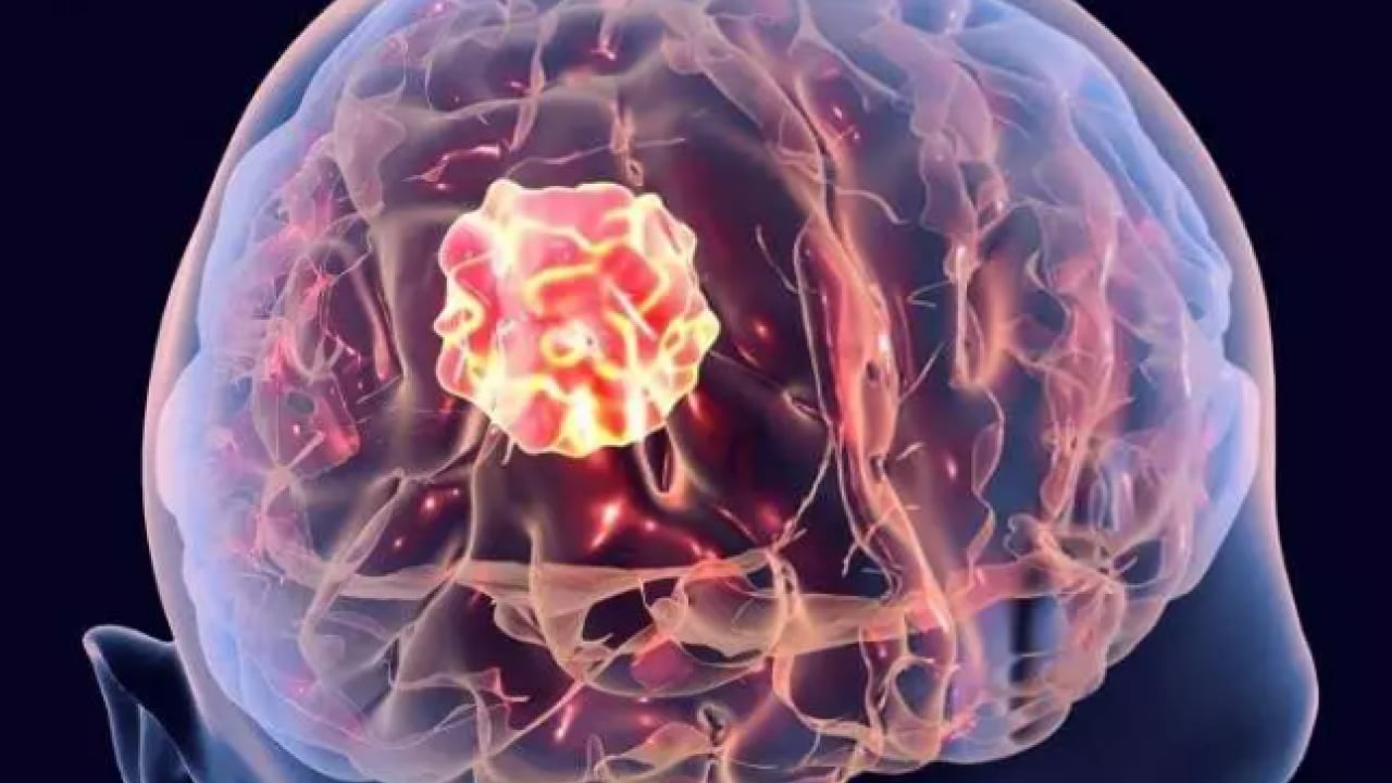 Foto - SGK listeyi paylaştı: Bu hastalığı olanlar malulen emekli olacak!