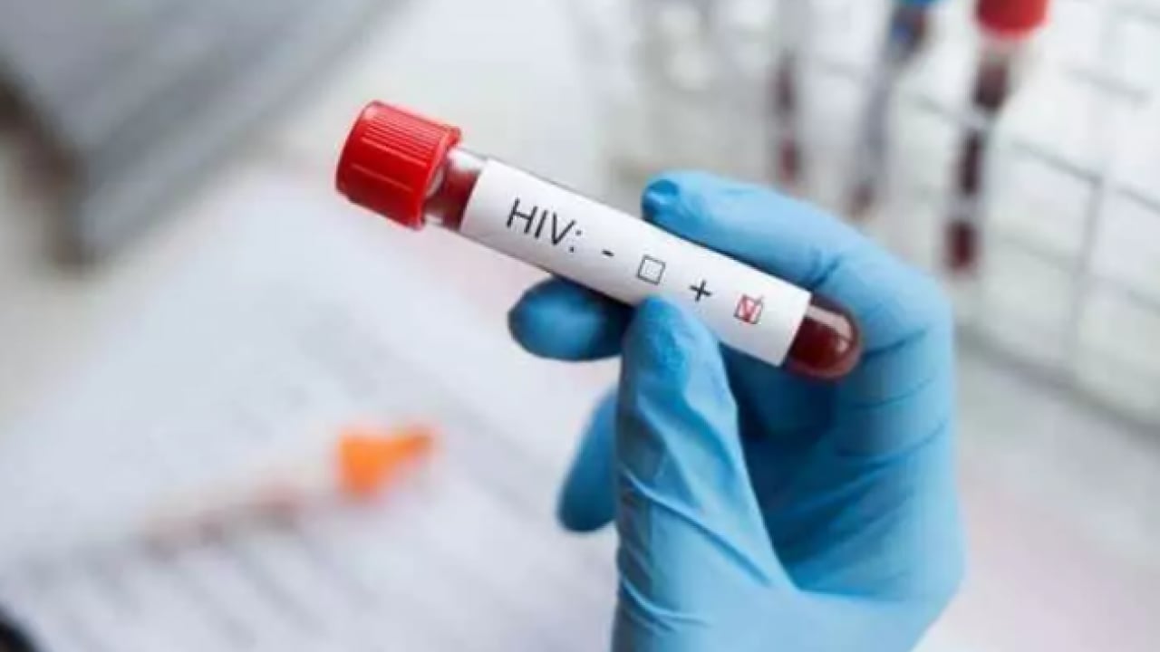 Foto - SGK listeyi paylaştı: Bu hastalığı olanlar malulen emekli olacak!