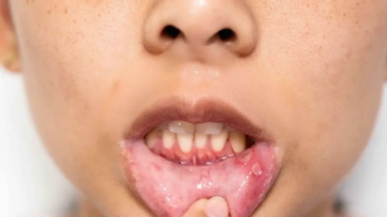 Foto - Sialendoskopi yöntemi öne çıktı: Susuzluk değil, uyarı: Ağız kuruluğu hafife alınmamalı