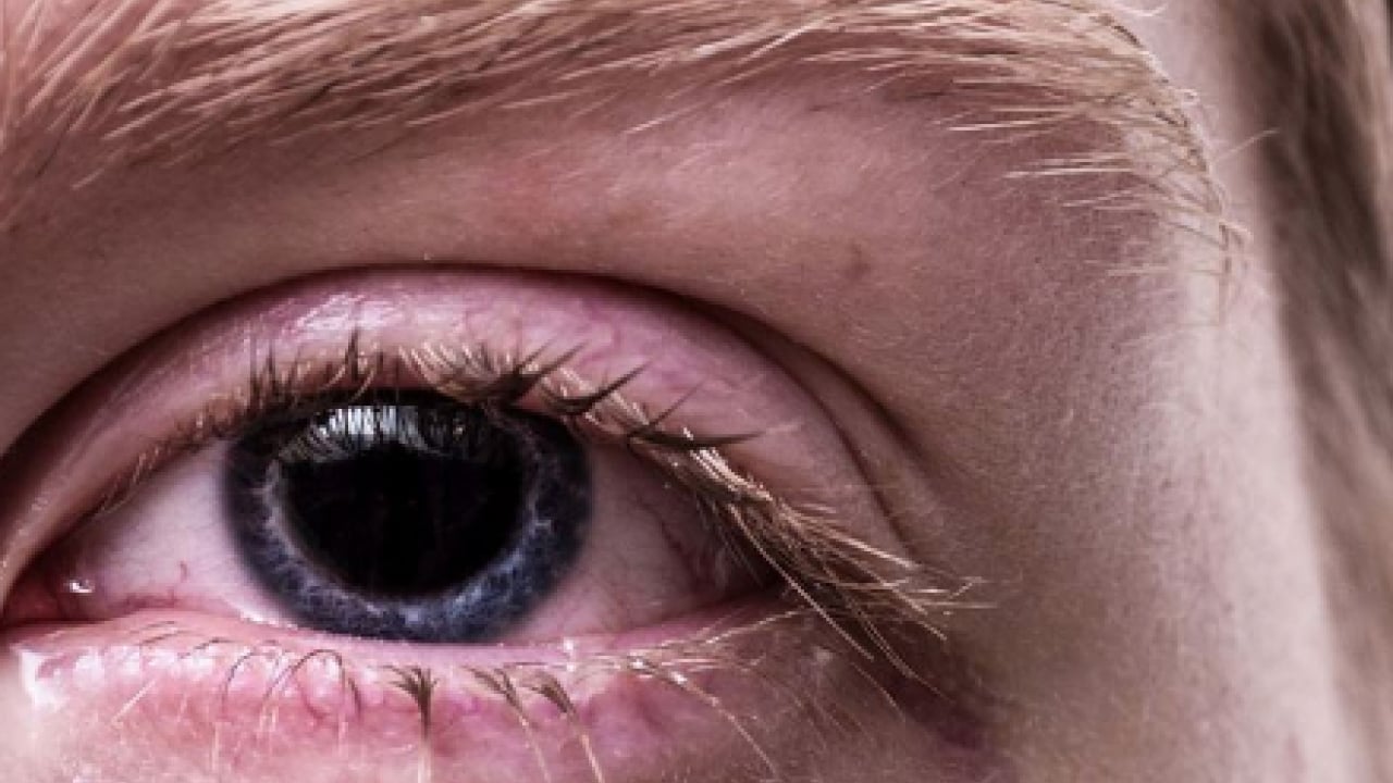 Foto - Sıcak havalar geldikçe... Bahar alerjisi gözleri etkiler mi? Bunu ihmal etmeyin yoksa?!?