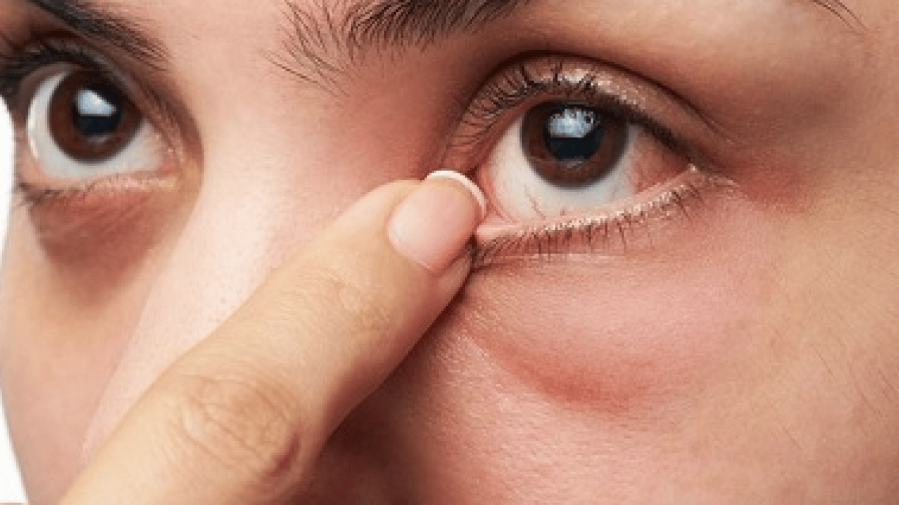 Foto - Sıcak havalar geldikçe... Bahar alerjisi gözleri etkiler mi? Bunu ihmal etmeyin yoksa?!?