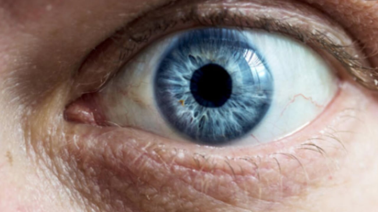 Sıcak havalar geldikçe... Bahar alerjisi gözleri etkiler mi? Bunu ihmal etmeyin yoksa?!?