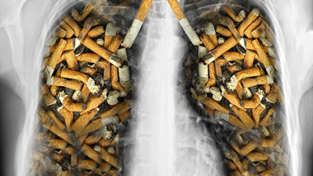 Foto - Sigara Dumanı Gözü Kör Ediyor!