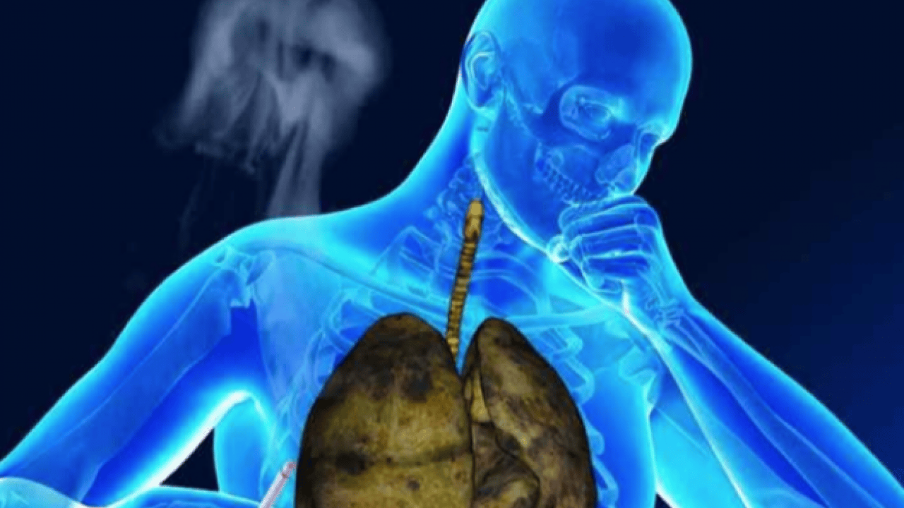 Sigara içen koah adayı! Uzmanı uyardı, önlemini al tavsiyesi verdi! Sigara kullananlar yandı zarar veriyor!