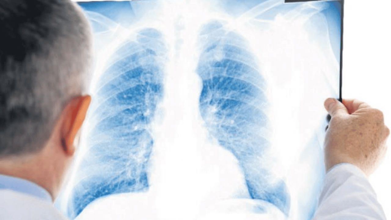 Foto - Sigara içen koah adayı! Uzmanı uyardı, önlemini al tavsiyesi verdi! Sigara kullananlar yandı zarar veriyor!