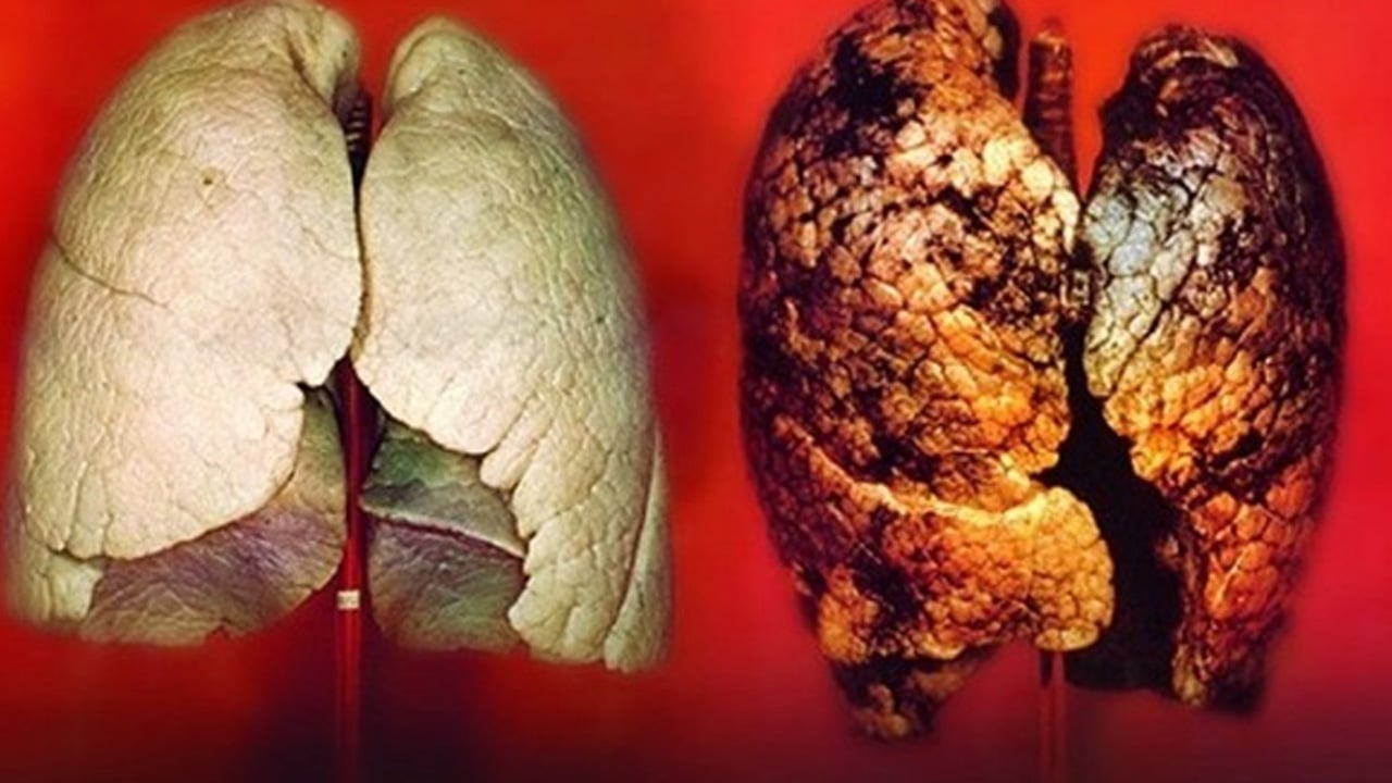 Sigara içenler, ölüm oranı birinci sırada! Uzmanlar ürküten açıklamayı yaptı! Akciğerleri adeta iflas ettiriyor