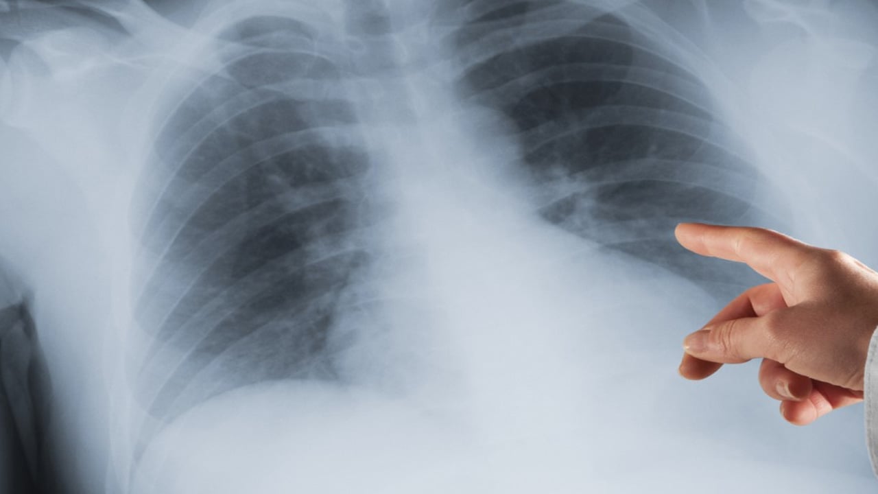 Foto - Sigara içenler, ölüm oranı birinci sırada! Uzmanlar ürküten açıklamayı yaptı! Akciğerleri adeta iflas ettiriyor