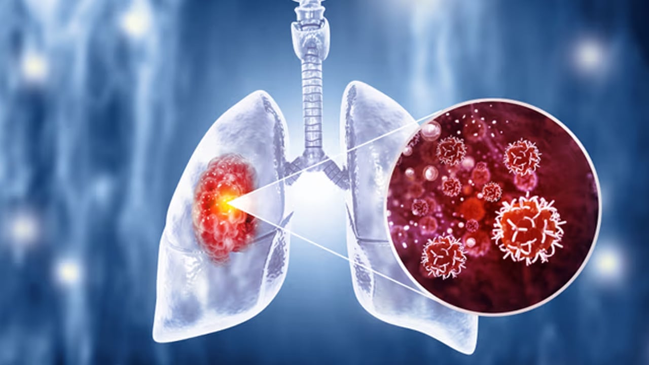 Foto - Sigara içenler, ölüm oranı birinci sırada! Uzmanlar ürküten açıklamayı yaptı! Akciğerleri adeta iflas ettiriyor