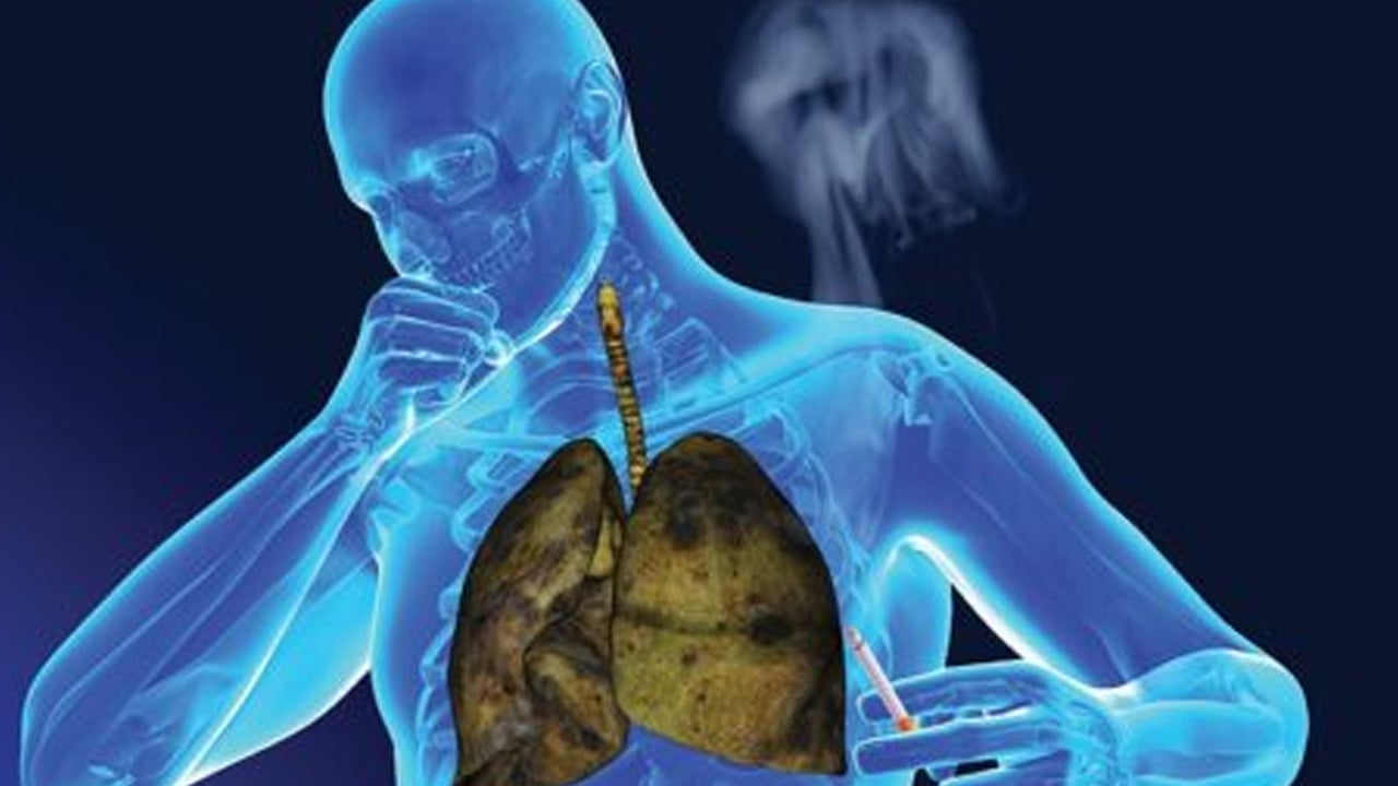 Foto - Sigara içenler, ölüm oranı birinci sırada! Uzmanlar ürküten açıklamayı yaptı! Akciğerleri adeta iflas ettiriyor