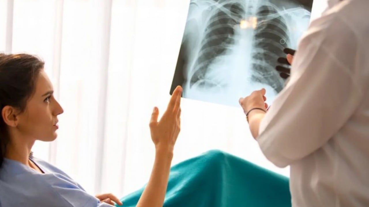 Foto - Sigarayı bırakıp ona geçiyorlar! Akciğerleri işlemez hale getiriyor!