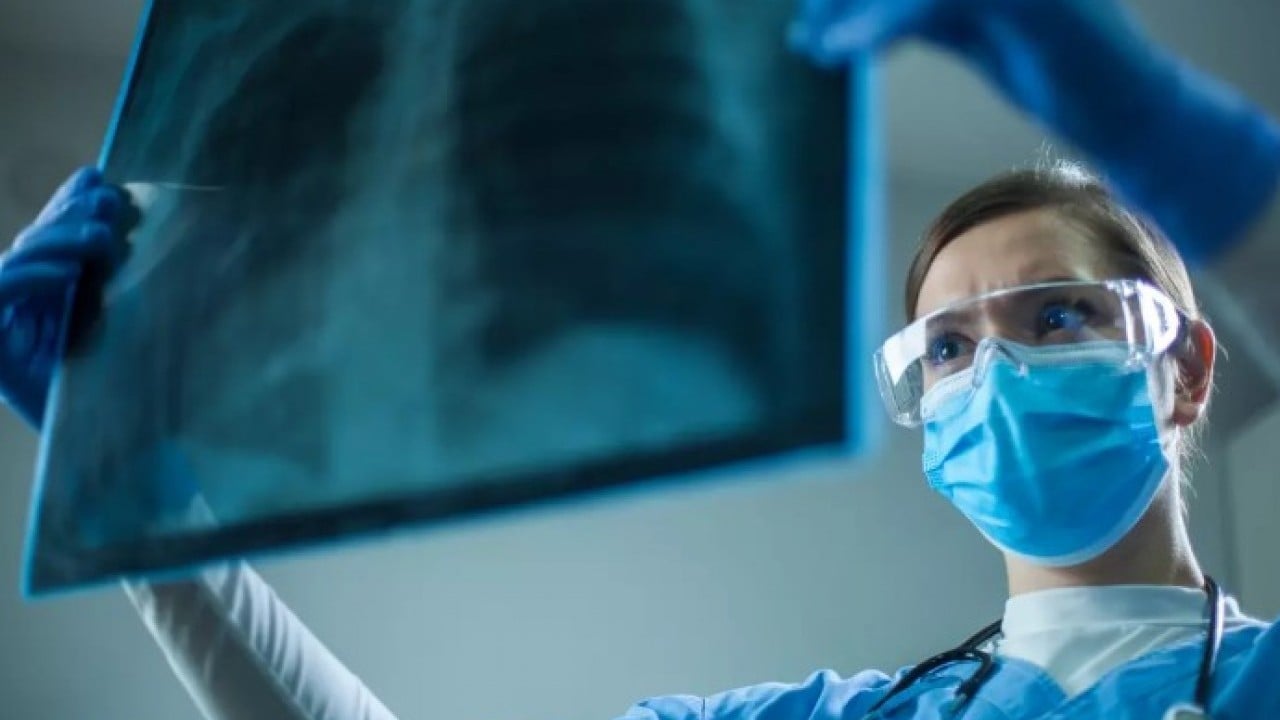 Foto - Sigarayı bırakıp ona geçiyorlar! Akciğerleri işlemez hale getiriyor!