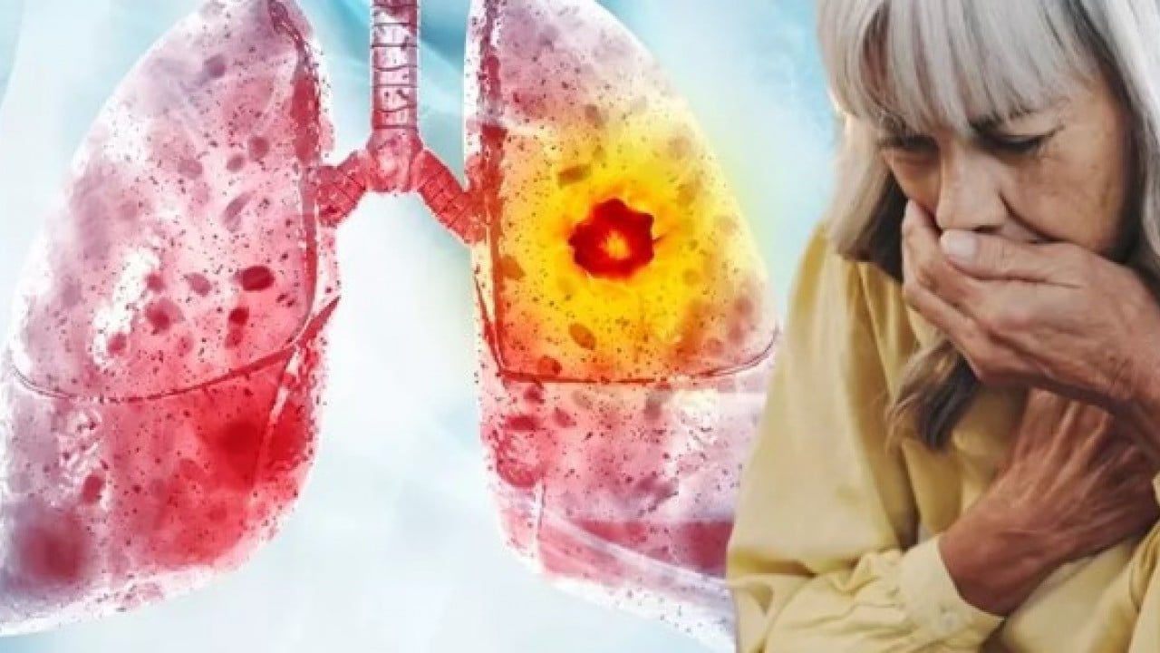 Sigarayı bırakıp ona geçiyorlar! Akciğerleri işlemez hale getiriyor!