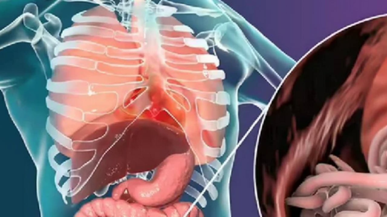 Foto - Sinsi tehlikeye dikkat: Bağırsak kurtları çocuğunuz için tehlike arz ediyor...