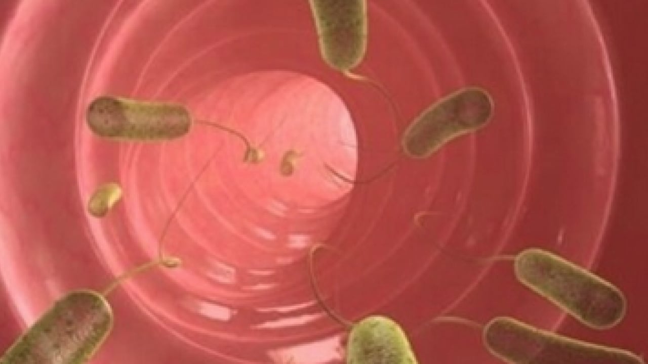 Foto - Sinsi tehlikeye dikkat: Bağırsak kurtları çocuğunuz için tehlike arz ediyor...