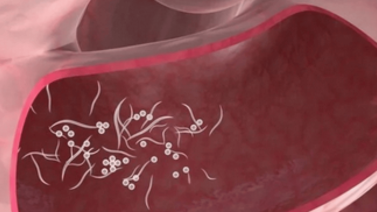 Sinsi tehlikeye dikkat: Bağırsak kurtları çocuğunuz için tehlike arz ediyor...